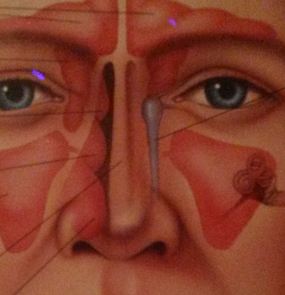 Curing Sinusitis Using a Non-Pharmaceutical Intervention